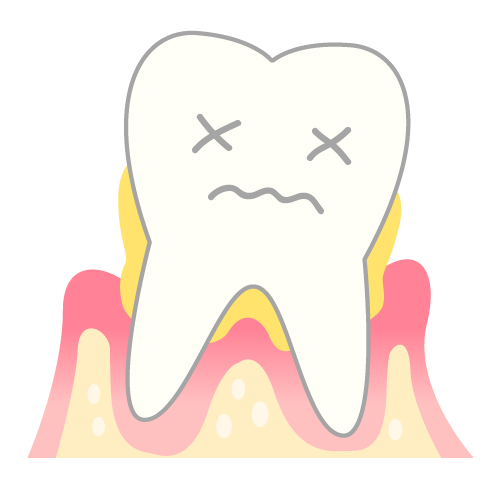 歯周病と全身疾患の関係性①